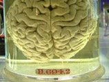 На интернет-аукционе eBay.com появились мозг и образцы крови, якобы принадлежащие диктатору