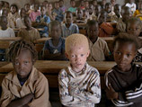 В странах Африки торговцы "необычным человеческим материалом" могут заработать до 75 тысяч долларов за "полный набор" из альбиноса африканского происхождения, в комплект обязательно должны входить конечности, гениталии, уши, язык и нос