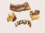 В зубоврачебном кабинете профессора Блашке при имперской канцелярии были обнаружены записи о лечении зубов и изготовлении зубных протезов для Гитлера
