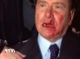 Тарталья с расстояния двух-трех метров запустил в него тяжелым сувенирным изображением Миланского собора Тарталья с расстояния двух-трех метров запустил в него тяжелым сувенирным изображением Миланского собора