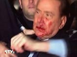 Избитый Берлускони стал популярнее: подозревают, что он сам подстроил нападение