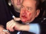 Избитый Берлускони стал популярнее: подозревают, что он сам подстроил нападение Избитый Берлускони стал популярнее: подозревают, что он сам подстроил нападение