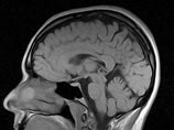 Особый участок мозга отвечает за справедливое распределение денег, выяснили японские ученые Особый участок мозга отвечает за справедливое распределение денег, выяснили японские ученые