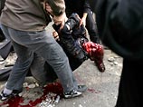 Племянник иранского оппозиционного лидера Мир-Хоссейна Мусави погиб во время антиправительственного протеста в Тегеране, сообщает в воскресенье агентство AFP Племянник иранского оппозиционного лидера Мир-Хоссейна Мусави погиб во время антиправительственного протеста в Тегеране, сообщает в воскресенье агентство AFP