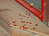 В Подмосковье под конец праздников собутыльники дошли до игры в вампиров: один остался без носа В Подмосковье под конец праздников собутыльники дошли до игры в вампиров: один остался без носа