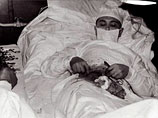 Советский хирург был настолько профессионален, что сам вырезал себе воспаленный аппендикс