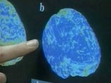 Ученые нашли в мозгу человека зону, ответственную за страх бежденежья Ученые нашли в мозгу человека зону, ответственную за страх бежденежья