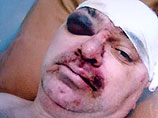 В Амурской области милиционер получил 3 года условно за превышение своих полномочий - при исполнении служебных обязанностей охранник правопорядка избил задержанного и сломал ему челюсть