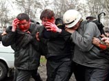 В результате беспорядков в Бишкеке погибли 75 человек, 1000 пострадали В результате беспорядков в Бишкеке погибли 75 человек, 1000 пострадали