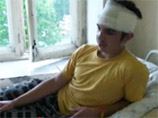 В Московской области сотрудник ФСБ выстрелил в голову школьнику, который мешал ему отдыхать