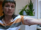 В Брянске избита бывшая глава отделения партии "Справедливая Россия"