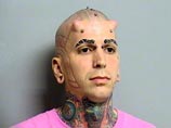 Полиция США арестовала мужчину, изуродовавшего себя клеймами и "дьявольскими наростами" на лбу