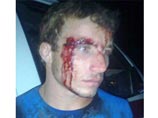 Краснодарский губернатор нанес Чечне ответный удар: в драке в лагере "Дон" лучше всего выступила милиция Краснодарский губернатор нанес Чечне ответный удар: в драке в лагере "Дон" лучше всего выступила милиция