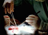 Установлено, что реципиенты за трансплантацию здоровой почки платили организаторам от 100 до 200 тысяч долларов. За каждую операцию украинские хирурги получали от 15 до 20 тысяч долларов