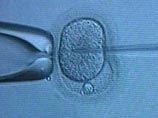 Суд США подтвердил запрет госфинансирования исследований стволовых клеток эмбрионов