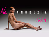 Стало известно о смерти модели Изабель Каро, олицетворявшей анорексию