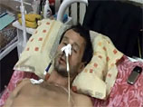 Задержанный за нахождение в нетрезвом виде в общественном месте житель хутора Калаборка Вячеслав Мереха после "общения" с милиционерами в опорном пункте попал в больницу в крайне тяжелом состоянии Задержанный за нахождение в нетрезвом виде в общественном месте житель хутора Калаборка Вячеслав Мереха после "общения" с милиционерами в опорном пункте попал в больницу в крайне тяжелом состоянии