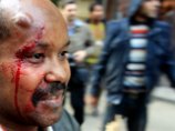 Японского телеоператора избили металлическими трубами сторонники Мубарака в Каире