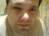 Владимирского блоггера по кличке Большевик будут судить за самопиар: после избиения собутыльником он обвинил во всем "наймитов "Единой России" Владимирского блоггера по кличке Большевик будут судить за самопиар: после избиения собутыльником он обвинил во всем "наймитов "Единой России"