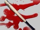 По словам Чириковой, Кузьмин "избит то ли битой, то ли металлическими прутами". Правда, при этом, по ее словам, сам журналист не связывает нападение с профессиональной либо общественной деятельностью По словам Чириковой, Кузьмин "избит то ли битой, то ли металлическими прутами". Правда, при этом, по ее словам, сам журналист не связывает нападение с профессиональной либо общественной деятельностью