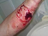 На Украине главврач больницы, торговавший наркотиками, покусал при задержании сотрудника прокуратуры На Украине главврач больницы, торговавший наркотиками, покусал при задержании сотрудника прокуратуры