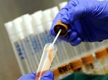 Немецкие власти нашли источник распространения опасного штамма кишечной бактерии Esherichia coli (E.coli) Немецкие власти нашли источник распространения опасного штамма кишечной бактерии Esherichia coli (E.coli)