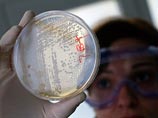 Ученые раскрыли секрет кишечной инфекции в Европе. России этого мало Ученые раскрыли секрет кишечной инфекции в Европе. России этого мало