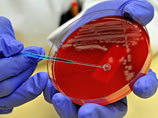 Вспышка острого инфекционного заболевания, вызванного кишечной бактерией E.coli, зафиксирована среди детей во французском Лилле