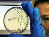 Первый случай гибели из-за вспышки кишечной инфекции зафиксирован во Франции, сообщил Департамент здравоохранения Бордо Первый случай гибели из-за вспышки кишечной инфекции зафиксирован во Франции, сообщил Департамент здравоохранения Бордо