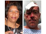 В Лондоне 51-летняя помощница мэра одного из предместий переломала мужчине ребра и челюсть
