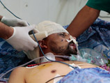 СМИ: в боях за Злитан убиты семеро ливийских повстанцев, 65 человек ранены