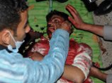 По крайней мере 26 человек были убиты в столице Йемена Сане в воскресенье, 18 сентября, в столкновениях с правительственными силами безопасности
