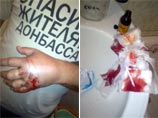 Киевлянин Андрей Орест был ранен неизвестными из-за футболки с надписью "Спасибо жителям Донбасса"