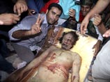 Премьер-министр Махмуд Джабриль утверждал ранее, что Каддафи умер от пулевого ранения в голову, однако теперь медики дали другое объяснение. Смертельной стала пуля, задевшая внутренние органы