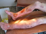 Францию переполошил российский "крокодил", предположительно убивший четырех человек Францию переполошил российский "крокодил", предположительно убивший четырех человек