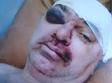 Скандальный инцидент произошел 11 марта 2010 года. Как сообщалось, в тот день к Кутузову подъехал конный патруль и предложил проследовать в отделение для определения наличия алкоголя в крови