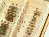 Разрезанный мозг Эйнштейна, поразивший ученых, выставили на всеобщее обозрение Разрезанный мозг Эйнштейна, поразивший ученых, выставили на всеобщее обозрение