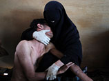 "Фотографией года-2011" по версии World Press Photo стала работа испанского фотографа Самуэля Аранда, сделанная во время вооруженных столкновений в Йемене. На фотографии изображена женщина, держащая на руках раненого родственника