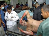 Погибшими в результате сильного пожара в тюрьме города Комаягуа в Гондурасе объявлены 357 человек