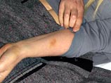 Прокуратура объяснила, откуда у Тимошенко синяки: она пострадала от "тупых и твердых предметов" Прокуратура объяснила, откуда у Тимошенко синяки: она пострадала от "тупых и твердых предметов"