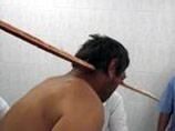 В Республике Адыгея врачам удалось спасти человека, которому двухметровой деревянной рейкой насквозь проткнуло голову
