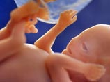 Народный избранник предлагает наделить статусом гражданина человеческие эмбрионы