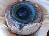 Биологи разгадали загадку огромного глаза, найденного на пляже во Флориде (ФОТО)