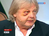 Суд города Видное Московской области в среду приступил к рассмотрению по существу уголовного дела в отношении мотоциклиста Александра Ишутина, которого певец и композитор Юрий Антонов обвиняет в избиении в ходе конфликта Суд города Видное Московской области в среду приступил к рассмотрению по существу уголовного дела в отношении мотоциклиста Александра Ишутина, которого певец и композитор Юрий Антонов обвиняет в избиении в ходе конфликта