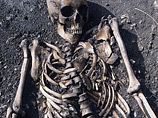 Женщина собрала скелет самостоятельно из костей, принадлежащих разным людям, полагает полиция