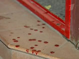 В Калининграде продавщица задержала вооруженного пистолетом грабителя, изрезав ему ножом ягодицы