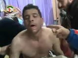 Сирийские мятежники утверждают, что их начали травить химическим оружием Сирийские мятежники утверждают, что их начали травить химическим оружием