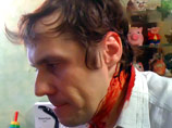 Аншакову досталось монтировкой, когда он возвращался от метро домой, его с сотрясением мозга и переломом руки госпитализировали в институт Склифософского