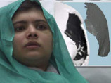 Пакистанской девочке-блоггеру реконструировали череп