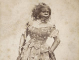 Родившаяся в мексиканском штате Синалоа в 1834 году Юлия Пастрана страдала от врожденного гипертрихоза и гиперплазии десен
